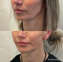 Load image into Gallery viewer, Day 12: Biostimulators - 2 Vial Treatment