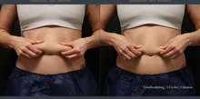 Load image into Gallery viewer, Day 3: Coolsculpting Elite Membership Deposit