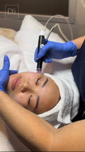 Load image into Gallery viewer, Day 5: Hydrafacial Platinum Plus - Buy 3 Get 1 Free