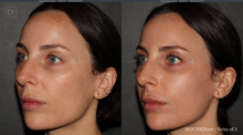 Load image into Gallery viewer, Day 9: NOUVADerm Face, Neck & Décolleté - Buy 3 Get 1 Free
