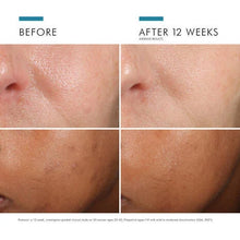 Load image into Gallery viewer, SkinCeuticals - Phloretin CF with Ferulic Acid