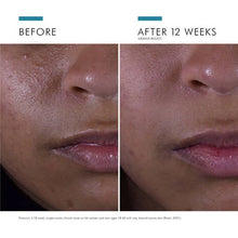 Load image into Gallery viewer, SkinCeuticals - Silymarin CF