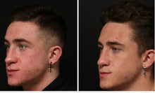 Load image into Gallery viewer, Alumier Peels for Face - Buy 3 Get 1 Free