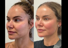 Load image into Gallery viewer, March Focus: SKINVIVE™ – Radiance Boosting Treatment - Face
