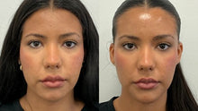 Load image into Gallery viewer, March Focus: SKINVIVE™ – Radiance Boosting Treatment - Face
