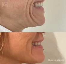 Load image into Gallery viewer, Day 12: Biostimulators - 2 Vial Treatment
