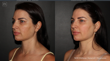 Load image into Gallery viewer, Day 9: NOUVADerm Face &amp; Neck - Buy 3 Get 1 Free

