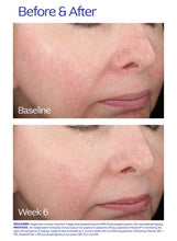 Load image into Gallery viewer, ZO Skin Health - Rozatrol
