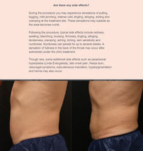 Load image into Gallery viewer, CoolSculpting Spring Refresh - $1,250 cash back on purchases of $4,500 or more.
